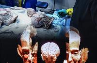 "Lekcja anatomii III", Gabriela Krystecka, lat 18, II Liceum Ogólnokształcące w Łowiczu